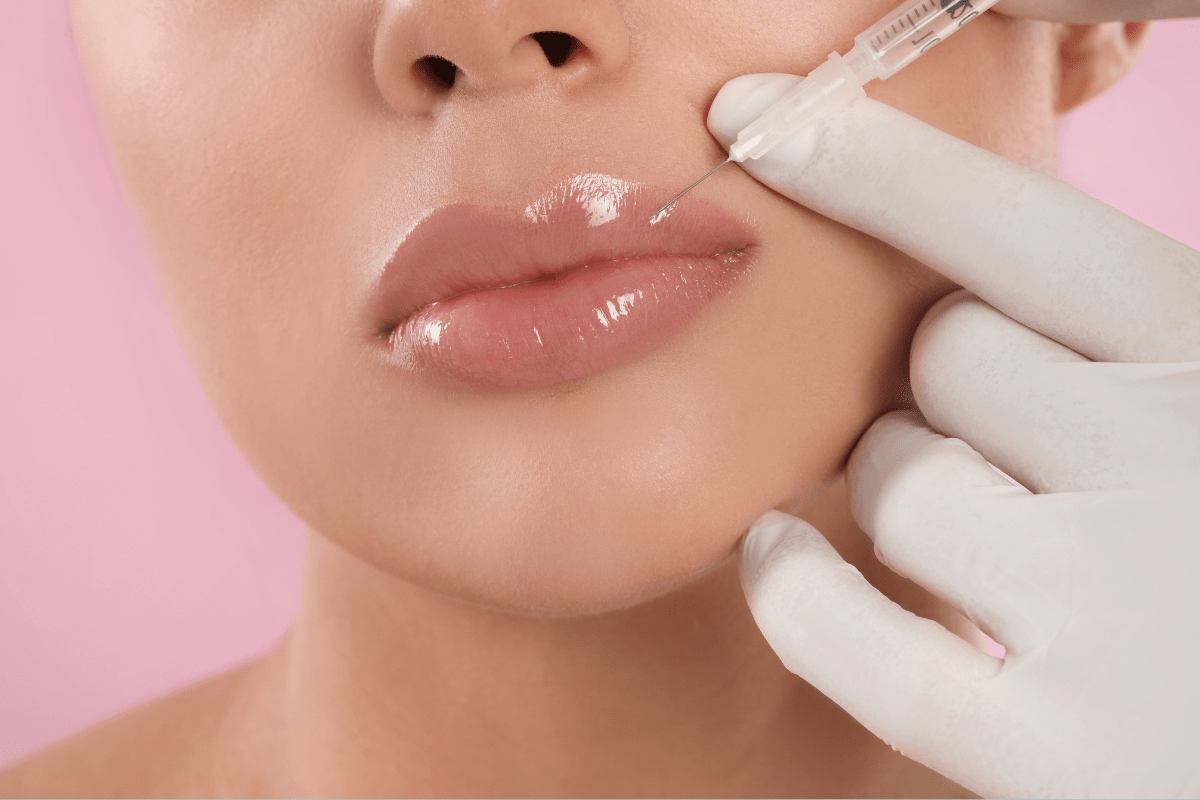 The Imitation of Black Beauty: Lip Fillers, Fake Tans, and the White Reinvention of Aesthetics