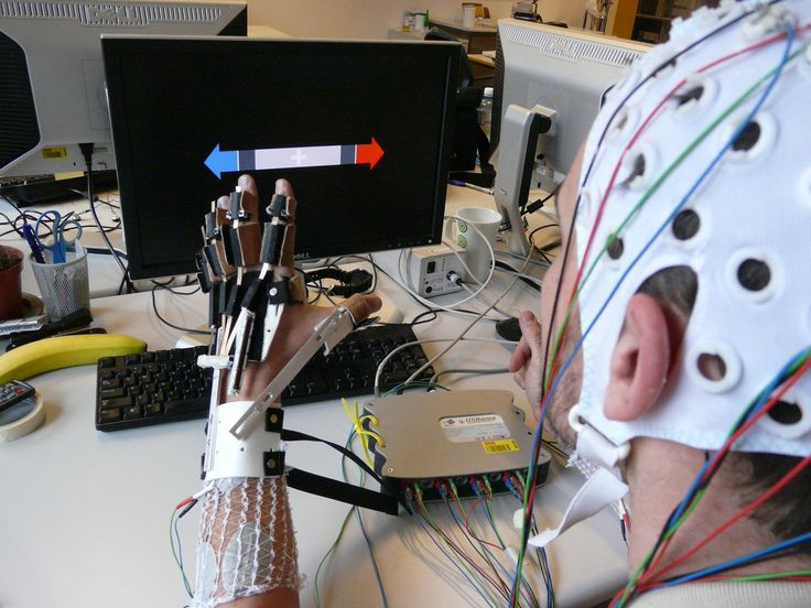 The Ethics of Brain-Computer Interfaces: When Technology Meets the Mind