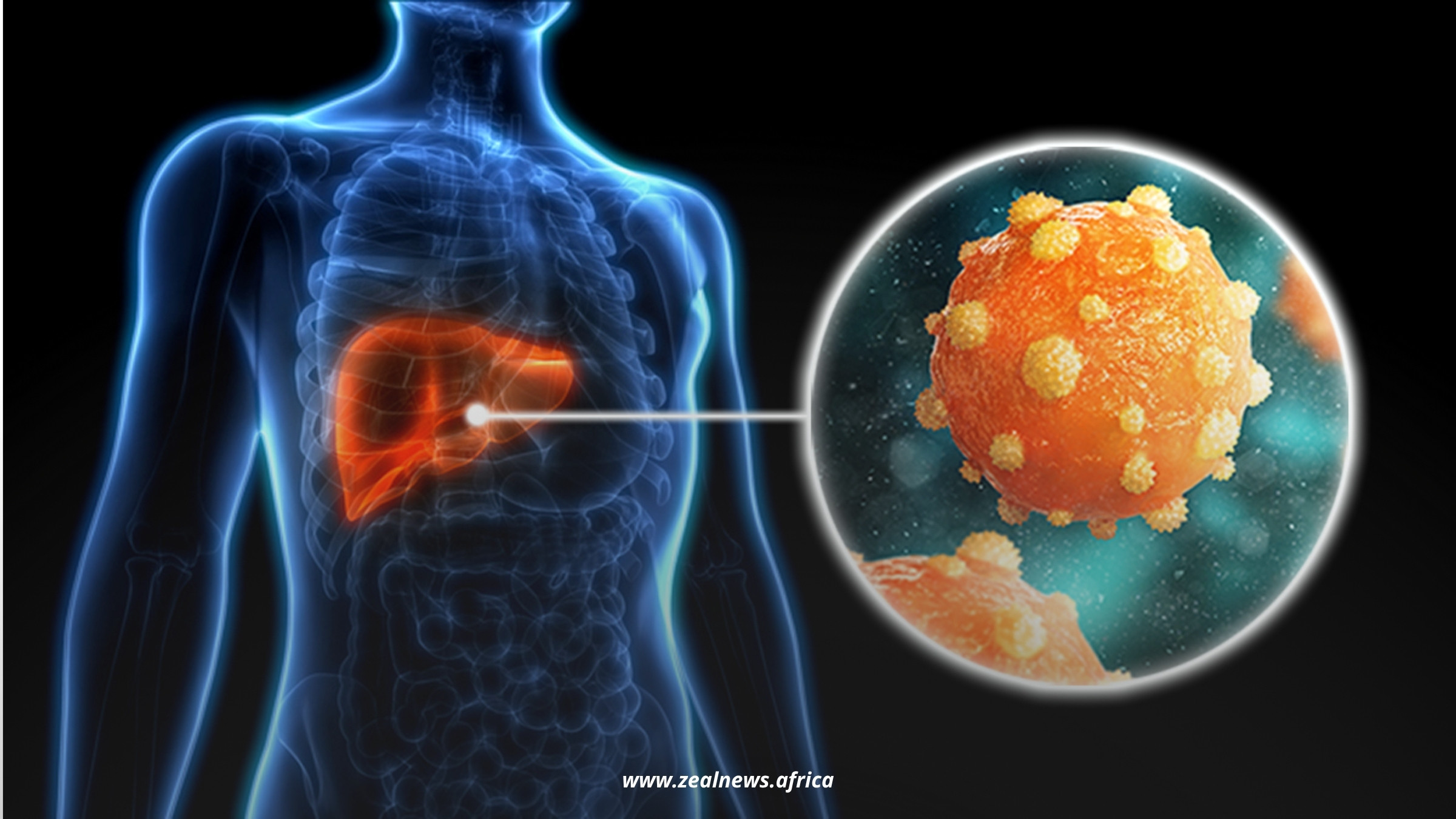 68% of New Hepatitis B Cases Are in Africa—What This Means for Nigeria