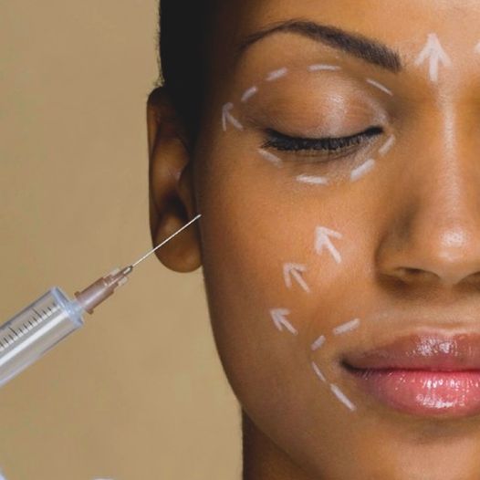 Youth in a Syringe: The Botox Boom Among Millennials and Gen Z