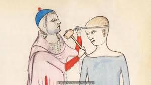 How the Bunyoro-Kitara Tribe Mastered Brain Surgery and C-Sections Centuries Before Modern Medicine